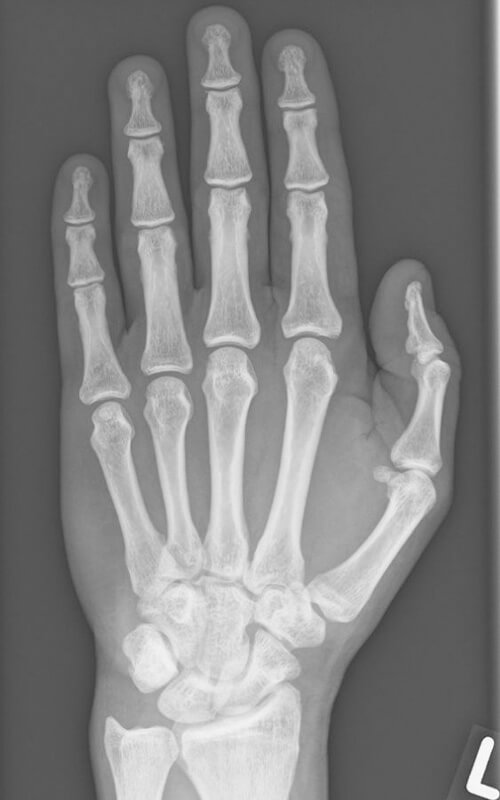 Rö_Hand_01-500x800